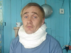 Нехаев спустя месяц после избиения. Нехаев спустя месяц после избиения.